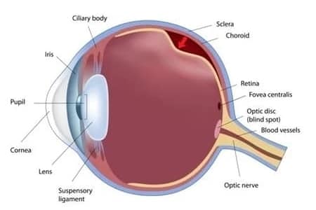 Retinal-detachment