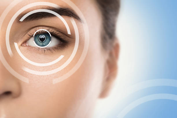 Advantages Of Topography Guided LASIK Over Others