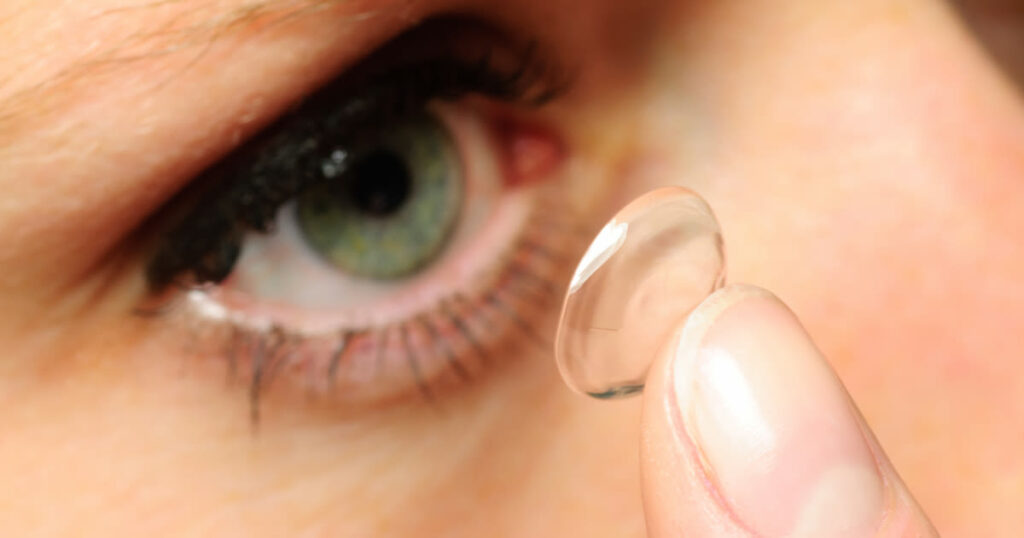 Contact Lenses after PRK: A Comprehensive Guide for Post-Surgery Eye Care