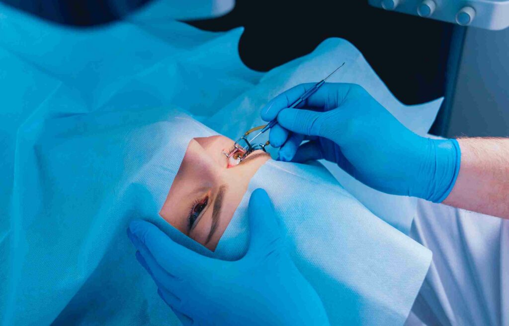 Corrective Vision Surgery