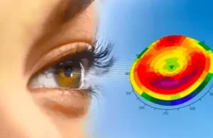 Which Is Better Femto LASIK Or Contoura?