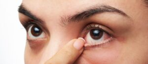 Is Femto Lasik Surgery Painful?
