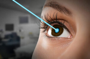 Different Types of LASIK