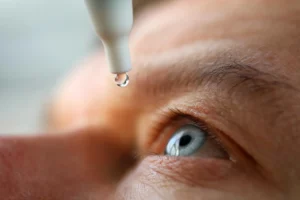 How To Treat Dryness In Eyes After LASIK