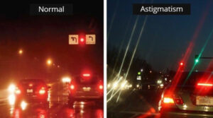 Is There Any Chance Of Astigmatism After LASIK?