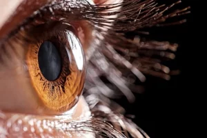 LASIK Surgery for Thin Cornea