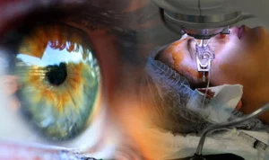 Wavefront Laser Eye Surgery
