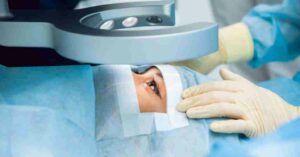 What Is Custom LASIK?