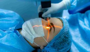 What Is LASIK Surgery?