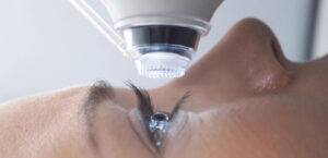 femto lasik