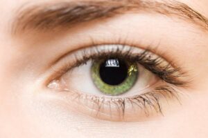 The Permanence of LASIK Surgery: An In-depth Insight