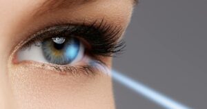 What Are The Similarities In SMILE vs LASIK?