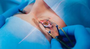 Unveiling the Best LASIK Surgeons Near You: Your Complete Guide