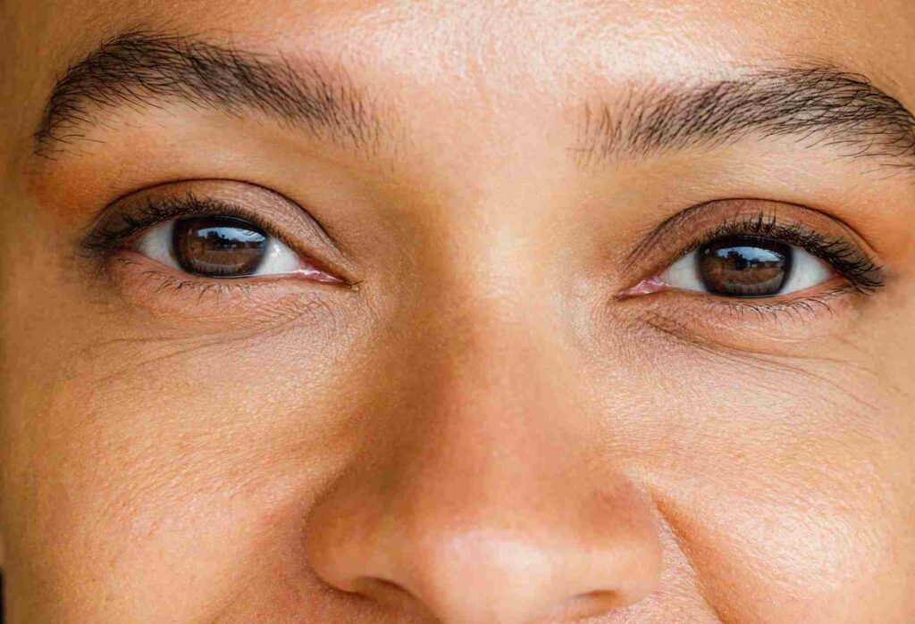 Revolutionizing Keratoconus Treatment: A Close Look at PRK and CXL