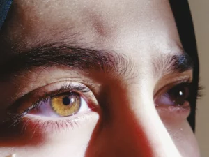 The Journey Beyond PRK: A Deep Dive Into LASIK After PRK Surgery
