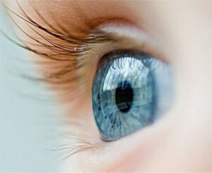 Multifocal LASIK