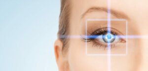 LASIK for Amblyopia