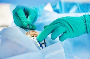 Is CLE Procedure Painful?