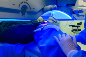 PRK Surgery for Keratoconus