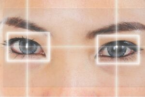 Relex Smile: Advancing Vision Correction Technology