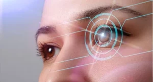 Recovery Time After Smile Eye Surgery?