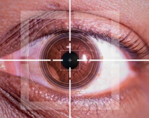 LASIK for Astigmatism: Improving Vision with Precision
