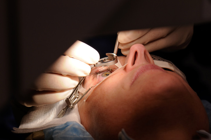 Refractive Surgery Procedure